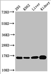 HIST1H3A Antibody - Western Blot Positive WB detected in: 293 whole cell lysate, K562 whole cell lysate, Rat liver tissue, Mouse kidney tissue All Lanes: HIST1H3A antibody at 0.52µg/ml Secondary Goat polyclonal to rabbit IgG at 1/50000 dilution Predicted band size: 16 KDa Observed band size: 16 KDa