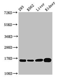 HIST1H3A Antibody - Western Blot Positive WB detected in: 293 whole cell lysate, K562 whole cell lysate, Rat liver tissue, Mouse kidney tissue All lanes: HIST1H3A antibody at 0.52µg/ml Secondary Goat polyclonal to rabbit IgG at 1/50000 dilution Predicted band size: 16 kDa Observed band size: 16 kDa