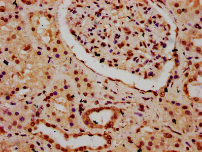 HIST1H3A Antibody - Immunohistochemistry Dilution at 1:20 and staining in paraffin-embedded human kidney tissue performed on a Leica BondTM system. After dewaxing and hydration, antigen retrieval was mediated by high pressure in a citrate buffer (pH 6.0). Section was blocked with 10% normal Goat serum 30min at RT. Then primary antibody (1% BSA) was incubated at 4°C overnight. The primary is detected by a biotinylated Secondary antibody and visualized using an HRP conjugated SP system.