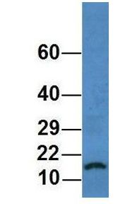 HIST1H3A Antibody - HIST1H3A antibody Western Blot of human 721_B. Antibody dilution: 1 ug/ml.  This image was taken for the unconjugated form of this product. Other forms have not been tested.