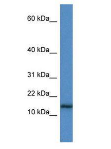 HIST1H3A Antibody - HIST1H3A antibody Western Blot of Jurkat.  This image was taken for the unconjugated form of this product. Other forms have not been tested.