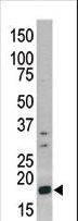 HIST1H3A Antibody - Western blot of anti-Phospho-H3-pS10 antibody in CEM cell line lysate (35 ug/lane). Phospho-H3-pS10(arrow) was detected using the purified antibody.