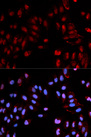 HIST1H3B Antibody - Immunofluorescence analysis of U2OS cells.
