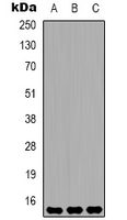 HIST1H3H Antibody - Western blot analysis of Histone H3 (Di-Methyl K36) expression in HeLa (A); Raw264.7 (B); rat brain (C) whole cell lysates.