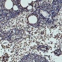 HIST1H3H Antibody - Immunohistochemical analysis of Histone H3 (Di-Methyl K36) staining in human colon formalin fixed paraffin embedded tissue section. The section was pre-treated using heat mediated antigen retrieval with sodium citrate buffer (pH 6.0). The section was then incubated with the antibody at room temperature and detected using an HRP conjugated compact polymer system. DAB was used as the chromogen. The section was then counterstained with hematoxylin and mounted with DPX.