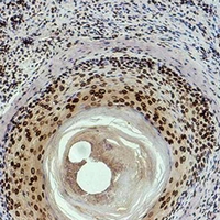 HIST1H3H Antibody - Immunohistochemical analysis of Histone H3 (Di-Methyl K9) staining in human skin formalin fixed paraffin embedded tissue section. The section was pre-treated using heat mediated antigen retrieval with sodium citrate buffer (pH 6.0). The section was then incubated with the antibody at room temperature and detected using an HRP conjugated compact polymer system. DAB was used as the chromogen. The section was then counterstained with hematoxylin and mounted with DPX.