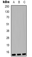 HIST1H3H Antibody - Western blot analysis of Histone H3 (Mono-Methyl K79) expression in HeLa (A); Raw264.7 (B); rat testis (C) whole cell lysates.