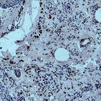 HIST1H3H Antibody - Immunohistochemical analysis of Histone H3 (Mono-Methyl K79) staining in human skin formalin fixed paraffin embedded tissue section. The section was pre-treated using heat mediated antigen retrieval with sodium citrate buffer (pH 6.0). The section was then incubated with the antibody at room temperature and detected using an HRP conjugated compact polymer system. DAB was used as the chromogen. The section was then counterstained with hematoxylin and mounted with DPX.