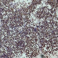 HIST1H3H Antibody - Immunohistochemical analysis of Histone H3 (Tri-Methyl K4) staining in human colon formalin fixed paraffin embedded tissue section. The section was pre-treated using heat mediated antigen retrieval with sodium citrate buffer (pH 6.0). The section was then incubated with the antibody at room temperature and detected using an HRP conjugated compact polymer system. DAB was used as the chromogen. The section was then counterstained with hematoxylin and mounted with DPX.