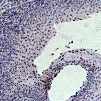 HIST1H3H Antibody - Immunohistochemical analysis of Histone H3 (Tri-Methyl K36) staining in human tonsil formalin fixed paraffin embedded tissue section. The section was pre-treated using heat mediated antigen retrieval with sodium citrate buffer (pH 6.0). The section was then incubated with the antibody at room temperature and detected using an HRP conjugated compact polymer system. DAB was used as the chromogen. The section was then counterstained with hematoxylin and mounted with DPX.