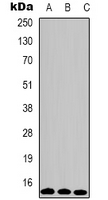 HIST1H3H Antibody - Western blot analysis of Histone H3 (Tri-Methyl K79) expression in HeLa (A); Raw264.7 (B); rat testis (C) whole cell lysates.