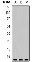 HIST1H3H Antibody - Western blot analysis of Histone H3 (Tri-Methyl K9) expression in HeLa (A); Raw264.7 (B); rat testis (C) whole cell lysates.