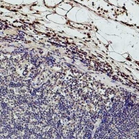 HIST1H3H Antibody - Immunohistochemical analysis of Histone H3 (Tri-Methyl K9) staining in human colon formalin fixed paraffin embedded tissue section. The section was pre-treated using heat mediated antigen retrieval with sodium citrate buffer (pH 6.0). The section was then incubated with the antibody at room temperature and detected using an HRP conjugated compact polymer system. DAB was used as the chromogen. The section was then counterstained with hematoxylin and mounted with DPX.