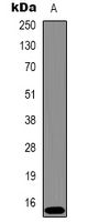 HIST1H3H Antibody - Western blot analysis of Histone H3 (Tri-Methyl K9) expression in HeLa (A) whole cell lysates.