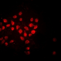 HIST1H3H Antibody - Immunofluorescent analysis of Histone H3 staining in HeLa cells. Formalin-fixed cells were permeabilized with 0.1% Triton X-100 in TBS for 5-10 minutes and blocked with 3% BSA-PBS for 30 minutes at room temperature. Cells were probed with the primary antibody in 3% BSA-PBS and incubated overnight at 4 deg C in a humidified chamber. Cells were washed with PBST and incubated with a DyLight 594-conjugated secondary antibody (red) in PBS at room temperature in the dark. DAPI was used to stain the cell nuclei (blue).