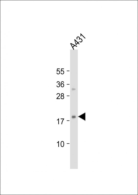 HIST1H3J Antibody - Anti-H3f3b Antibody (Center) at 1:2000 dilution + A431 whole cell lysate Lysates/proteins at 20 ug per lane. Secondary Goat Anti-Rabbit IgG, (H+L), Peroxidase conjugated at 1:10000 dilution. Predicted band size: 15 kDa. Blocking/Dilution buffer: 5% NFDM/TBST.