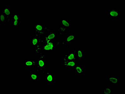 HIST1H4I Antibody - Immunofluorescent analysis of Hela cells treated with NaB at a dilution of 1:100 and Alexa Fluor 488-congugated AffiniPure Goat Anti-Rabbit IgG(H+L)
