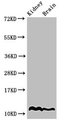 HIST1H4I Antibody - Positive Western Blot detected in Mouse kidney tissue, Mouse brain tissue. All lanes: HIST1H4A antibody at 2 µg/ml Secondary Goat polyclonal to rabbit IgG at 1/50000 dilution. Predicted band size: 12 KDa. Observed band size: 12 KDa
