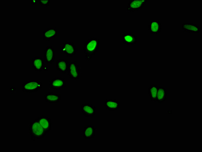 HIST1H4I Antibody - Immunofluorescence staining of Hela cells at a dilution of 1:25, counter-stained with DAPI. The cells were fixed in 4% formaldehyde, permeabilized using 0.2% Triton X-100 and blocked in 10% normal Goat Serum. The cells were then incubated with the antibody overnight at 4 °C.The secondary antibody was Alexa Fluor 488-congugated AffiniPure Goat Anti-Rabbit IgG (H+L) .