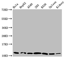 HIST1H4I Antibody - Positive Western Blot detected in Hela whole cell lysate, HepG2 whole cell lysate, A549 whole cell lysate, 293 whole cell lysate, K562 whole cell lysate, Rat spleen tissue, Mouse kidney tissue. All lanes: HIST1H4A antibody at 0.29 µg/ml Secondary Goat polyclonal to rabbit IgG at 1/50000 dilution. Predicted band size: 12 KDa. Observed band size: 12 KDa