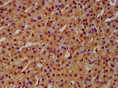 HIST1H4I Antibody - Immunohistochemistry image at a dilution of 1:100 and staining in paraffin-embedded human adrenal gland tissue performed on a Leica BondTM system. After dewaxing and hydration, antigen retrieval was mediated by high pressure in a citrate buffer (pH 6.0) . Section was blocked with 10% normal goat serum 30min at RT. Then primary antibody (1% BSA) was incubated at 4 °C overnight. The primary is detected by a biotinylated secondary antibody and visualized using an HRP conjugated SP system.