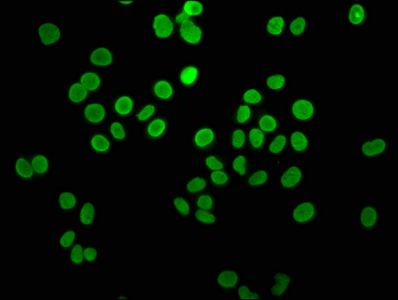 HIST1H4I Antibody - Immunofluorescence staining of Hela cells with DAPI. The cells were fixed in 4% formaldehyde, permeabilized using 0.2% Triton X-100 and blocked in 10% normal Goat Serum. The cells were then incubated with the antibody overnight at 4°C.The secondary antibody was Alexa Fluor 488-congugated AffiniPure Goat Anti-Rabbit IgG (H+L) .