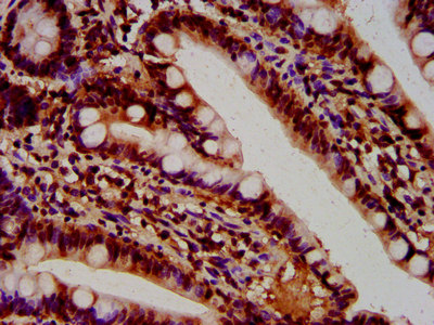 HIST1H4I Antibody - Immunohistochemistry image at a dilution of 1:100 and staining in paraffin-embedded human small intestine tissue performed on a Leica BondTM system. After dewaxing and hydration, antigen retrieval was mediated by high pressure in a citrate buffer (pH 6.0) . Section was blocked with 10% normal goat serum 30min at RT. Then primary antibody (1% BSA) was incubated at 4 °C overnight. The primary is detected by a biotinylated secondary antibody and visualized using an HRP conjugated SP system.