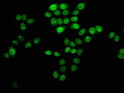 HIST1H4I Antibody - Immunofluorescence staining of Hela cells (treated with 30mM sodium crotonylate for 4h) with DAPI. The cells were fixed in 4% formaldehyde, permeabilized using 0.2% Triton X-100 and blocked in 10% normal Goat Serum. The cells were then incubated with the antibody overnight at 4 °C.The secondary antibody was Alexa Fluor 488-congugated AffiniPure Goat Anti-Rabbit IgG (H+L) .
