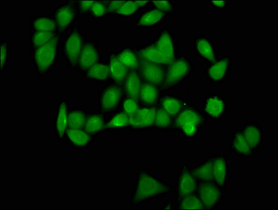 HIST1H4I Antibody - Immunofluorescence staining of Hela cells(treated with 10mM disodium succinylate for 4h) with DAPI. The cells were fixed in 4% formaldehyde, permeabilized using 0.2% Triton X-100 and blocked in 10% normal Goat Serum. The cells were then incubated with the antibody overnight at 4 °C.The secondary antibody was Alexa Fluor 488-congugated AffiniPure Goat Anti-Rabbit IgG (H+L) .
