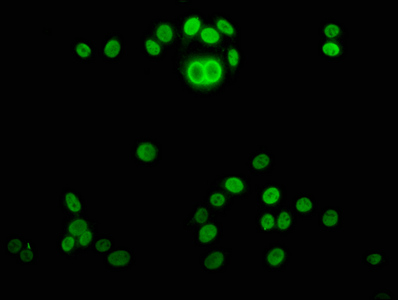 HIST1H4I Antibody - Immunofluorescence staining of HepG2 cells(treated with 30mM sodium butyrate for 4h) with DAPI. The cells were fixed in 4% formaldehyde, permeabilized using 0.2% Triton X-100 and blocked in 10% normal Goat Serum. The cells were then incubated with the antibody overnight at 4 °C.The secondary antibody was Alexa Fluor 488-congugated AffiniPure Goat Anti-Rabbit IgG (H+L) .