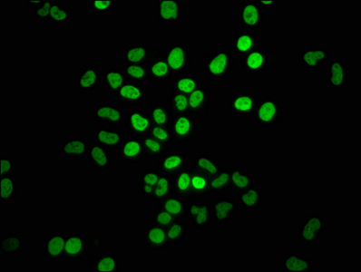 HIST1H4I Antibody - Immunofluorescence staining of Hela cells with DAPI. The cells were fixed in 4% formaldehyde, permeabilized using 0.2% Triton X-100 and blocked in 10% normal Goat Serum. The cells were then incubated with the antibody overnight at 4 °C.The secondary antibody was Alexa Fluor 488-congugated AffiniPure Goat Anti-Rabbit IgG (H+L) .