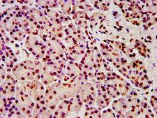 HIST1H4I Antibody - Immunohistochemistry image at a dilution of 1:5 and staining in paraffin-embedded human pancreatic tissue performed on a Leica BondTM system. After dewaxing and hydration, antigen retrieval was mediated by high pressure in a citrate buffer (pH 6.0) . Section was blocked with 10% normal goat serum 30min at RT. Then primary antibody (1% BSA) was incubated at 4 °C overnight. The primary is detected by a biotinylated secondary antibody and visualized using an HRP conjugated SP system.