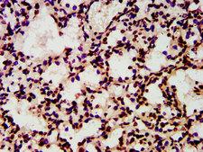 HIST1H4I Antibody - Immunohistochemistry image at a dilution of 1:10 and staining in paraffin-embedded human lung tissue performed on a Leica BondTM system. After dewaxing and hydration, antigen retrieval was mediated by high pressure in a citrate buffer (pH 6.0) . Section was blocked with 10% normal goat serum 30min at RT. Then primary antibody (1% BSA) was incubated at 4 °C overnight. The primary is detected by a biotinylated secondary antibody and visualized using an HRP conjugated SP system.