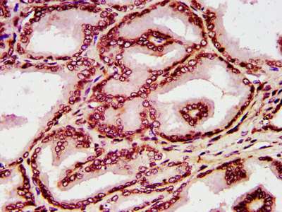 HIST1H4I Antibody - Immunohistochemistry image at a dilution of 1:10 and staining in paraffin-embedded human prostate tissue performed on a Leica BondTM system. After dewaxing and hydration, antigen retrieval was mediated by high pressure in a citrate buffer (pH 6.0) . Section was blocked with 10% normal goat serum 30min at RT. Then primary antibody (1% BSA) was incubated at 4 °C overnight. The primary is detected by a biotinylated secondary antibody and visualized using an HRP conjugated SP system.
