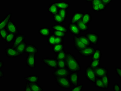 HIST1H4I Antibody - Immunofluorescence staining of Hela cells (treated with 30mM sodium butyrate for 4h) with DAPI. The cells were fixed in 4% formaldehyde, permeabilized using 0.2% Triton X-100 and blocked in 10% normal Goat Serum. The cells were then incubated with the antibody overnight at 4 °C.The secondary antibody was Alexa Fluor 488-congugated AffiniPure Goat Anti-Rabbit IgG (H+L) .