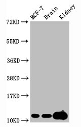 HIST1H4I Antibody - Western Blot Positive WB detected in:MCF-7 whole cell lysate, Mouse brain tissue,Mouse kidney tissue All Lanes:Tri-methyl-Histone H4 (K20) antibody at 2.15µg/ml Secondary Goat polyclonal to rabbit IgG at 1/50000 dilution Predicted band size: 11 KDa Observed band size: 11 KDa