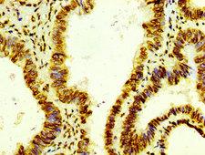 HIST1H4I Antibody - Immunohistochemistry Dilution at 1:100 and staining in paraffin-embedded human colon cancer performed on a Leica BondTM system. After dewaxing and hydration, antigen retrieval was mediated by high pressure in a citrate buffer (pH 6.0). Section was blocked with 10% normal Goat serum 30min at RT. Then primary antibody (1% BSA) was incubated at 4°C overnight. The primary is detected by a biotinylated Secondary antibody and visualized using an HRP conjugated SP system.