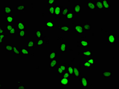 HIST1H4I Antibody - Immunofluorescence staining of Hela cells diluted at 1:50,counter-stained with DAPI. The cells were fixed in 4% formaldehyde, permeabilized using 0.2% Triton X-100 and blocked in 10% normal Goat Serum. The cells were then incubated with the antibody overnight at 4°C.The Secondary antibody was Alexa Fluor 488-congugated AffiniPure Goat Anti-Rabbit IgG (H+L).