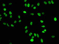 HIST1H4I Antibody - Immunofluorescence staining of Hela cells diluted at 1:50,counter-stained with DAPI. The cells were fixed in 4% formaldehyde, permeabilized using 0.2% Triton X-100 and blocked in 10% normal Goat Serum. The cells were then incubated with the antibody overnight at 4°C.The Secondary antibody was Alexa Fluor 488-congugated AffiniPure Goat Anti-Rabbit IgG (H+L).