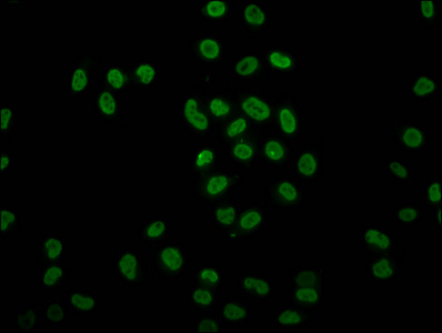HIST1H4I Antibody - Immunofluorescence staining of Hela cells (treated with 30mM sodium butyrate for 4h) diluted at 1:7.5, counter-stained with DAPI. The cells were fixed in 4% formaldehyde, permeabilized using 0.2% Triton X-100 and blocked in 10% normal Goat Serum. The cells were then incubated with the antibody overnight at 4°C.The Secondary antibody was Alexa Fluor 488-congugated AffiniPure Goat Anti-Rabbit IgG (H+L) .