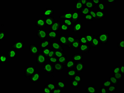 HIST1H4I Antibody - Immunofluorescence staining of Hela cells (treated with 30mM sodium butyrate for 4h) diluted at 1:5, counter-stained with DAPI. The cells were fixed in 4% formaldehyde, permeabilized using 0.2% Triton X-100 and blocked in 10% normal Goat Serum. The cells were then incubated with the antibody overnight at 4°C.The Secondary antibody was Alexa Fluor 488-congugated AffiniPure Goat Anti-Rabbit IgG (H+L) .