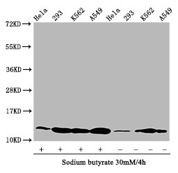 HIST1H4I Antibody - Western Blot Positive WB detected in: Hela whole cell lysate, 293 whole cell lysate, K562 whole cell lysate, A549 whole cell lysate(treated with 30mM sodium butyrate for 4h or not) All Lanes: HIST1H4A antibody at 1.1µg/ml Secondary Goat polyclonal to rabbit IgG at 1/50000 dilution Predicted band size: 12 KDa Observed band size: 12 KDa