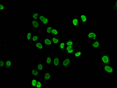 HIST1H4I Antibody - Immunofluorescence staining of Hela cells (treated with 30mM sodium butyrate for 4h) diluted at 1:50, counter-stained with DAPI. The cells were fixed in 4% formaldehyde, permeabilized using 0.2% Triton X-100 and blocked in 10% normal Goat Serum. The cells were then incubated with the antibody overnight at 4°C.The Secondary antibody was Alexa Fluor 488-congugated AffiniPure Goat Anti-Rabbit IgG (H+L) .