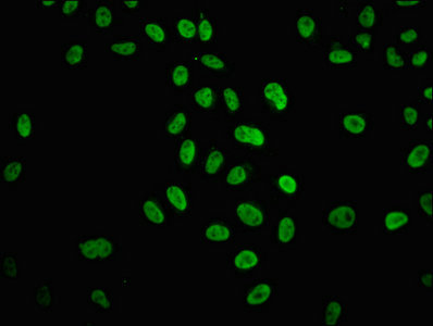 HIST1H4I Antibody - Immunofluorescence staining of Hela cells (treated with 30mM sodium butyrate for 4h) with Acetyl-HIST1H4A (K31) Antibody at 1:12.5, counter-stained with DAPI. The cells were fixed in 4% formaldehyde, permeabilized using 0.2% Triton X-100 and blocked in 10% normal Goat Serum. The cells were then incubated with the antibody overnight at 4°C. The secondary antibody was Alexa Fluor 488-congugated AffiniPure Goat Anti-Rabbit IgG(H+L).