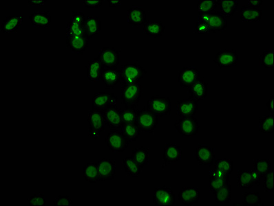 HIST1H4I Antibody - Immunofluorescence staining of Hela cells (treated with 30mM sodium butyrate for 4h) diluted at 1:5, counter-stained with DAPI. The cells were fixed in 4% formaldehyde, permeabilized using 0.2% Triton X-100 and blocked in 10% normal Goat Serum. The cells were then incubated with the antibody overnight at 4°C.The Secondary antibody was Alexa Fluor 488-congugated AffiniPure Goat Anti-Rabbit IgG (H+L) .