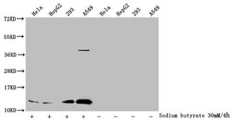 HIST1H4I Antibody - Western Blot Detected samples: Hela whole cell lysate, HepG2 whole cell lysate, 293 whole cell lysate, A549 whole cell lysate; Untreated (-) or treated (+) with 30mM sodium butyrate for 4h All lanes: HIST1H4A antibody at 1:1000 Secondary Goat polyclonal to rabbit IgG at 1/40000 dilution Predicted band size: 12 kDa Observed band size: 12 kDa