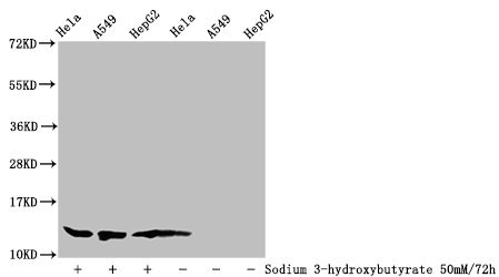 HIST1H4I Antibody - Western Blot Detected samples: Hela whole cell lysate, A549 whole cell lysate, HepG2 whole cell lysate; Untreated (-) or treated (+) with 50mM Sodium 3-hydroxybutyrate for 72h All lanes: HIST1H4A antibody at 1:100 Secondary Goat polyclonal to rabbit IgG at 1/50000 dilution Predicted band size: 12 kDa Observed band size: 12 kDa