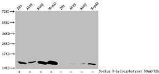 HIST1H4I Antibody - Western Blot Detected samples: 293 whole cell lysate, A549 whole cell lysate, K562 whole cell lysate, HepG2 whole cell lysate; Untreated (-) or treated (+) with 50mM Sodium 3-hydroxybutyrate for 72h All lanes: HIST1H4A antibody at 1:1000 Secondary Goat polyclonal to rabbit IgG at 1/40000 dilution Predicted band size: 12 kDa Observed band size: 12 kDa