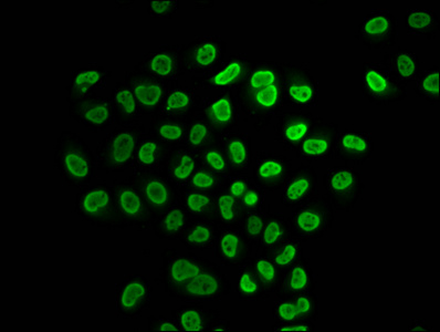 HIST1H4I Antibody - Immunofluorescence staining of Hela cells (treated with 30mM sodium butyrate for 4h) diluted at 1:25, counter-stained with DAPI. The cells were fixed in 4% formaldehyde, permeabilized using 0.2% Triton X-100 and blocked in 10% normal Goat Serum. The cells were then incubated with the antibody overnight at 4°C.The Secondary antibody was Alexa Fluor 488-congugated AffiniPure Goat Anti-Rabbit IgG (H+L) .