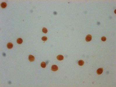 HIST1H4I Antibody - Immunocytochemistry analysis of Butyrly-HIST1H4A (K31) Antibody diluted at 1:50 and staining in Hela cells (treated with 30mM sodium butyrate for 4h) performed on a Leica BondTM system. The cells were fixed in 4% formaldehyde, permeabilized using 0.2% Triton X-100 and blocked with 10% normal goat serum 30min at RT. Then primary antibody (1% BSA) was incubated at 4°C overnight. The primary is detected by a biotinylated secondary antibody and visualized using an HRP conjugated SP system.
